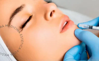 Innovación en Tecnología Estética: Mesoterapia Facial con Vitaminas y Hialuronidasa para la Eliminación de Ácido Hialurónico en Labios