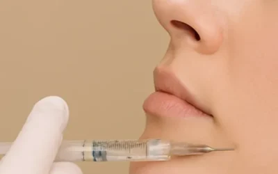 Profhilo en Valencia: Biotecnología avanzada para la regeneración de la piel